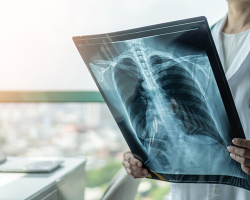 Digital X-Ray Imaging
