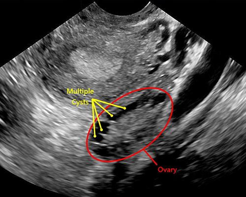 Infertility-Related Scans