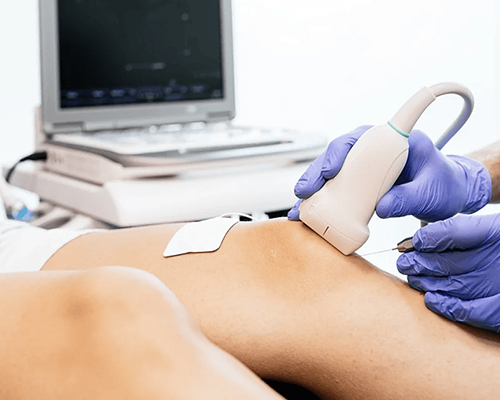 Musculoskeletal Ultrasound